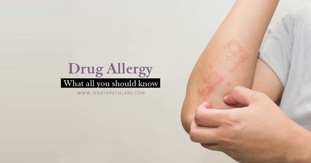 Shocking Truth About Drug Allergies! Uncover Symptoms & Diagnosis ...