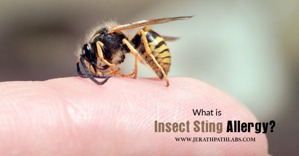 test-required-for-insect-sting-shocking-truth-about-insect-sting-allergy