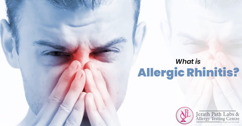 Beat Sneezes Discover Allergy Rhinitis Relief Tricks And Tests